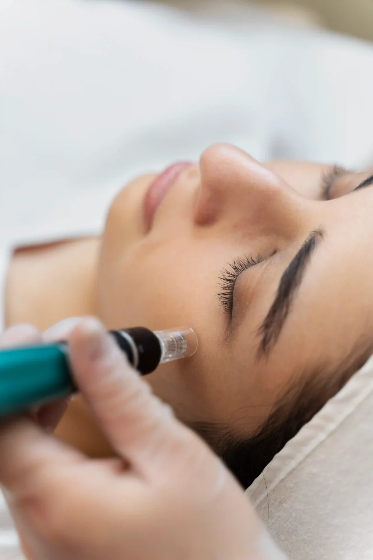 Dermapen estética dharma Denia